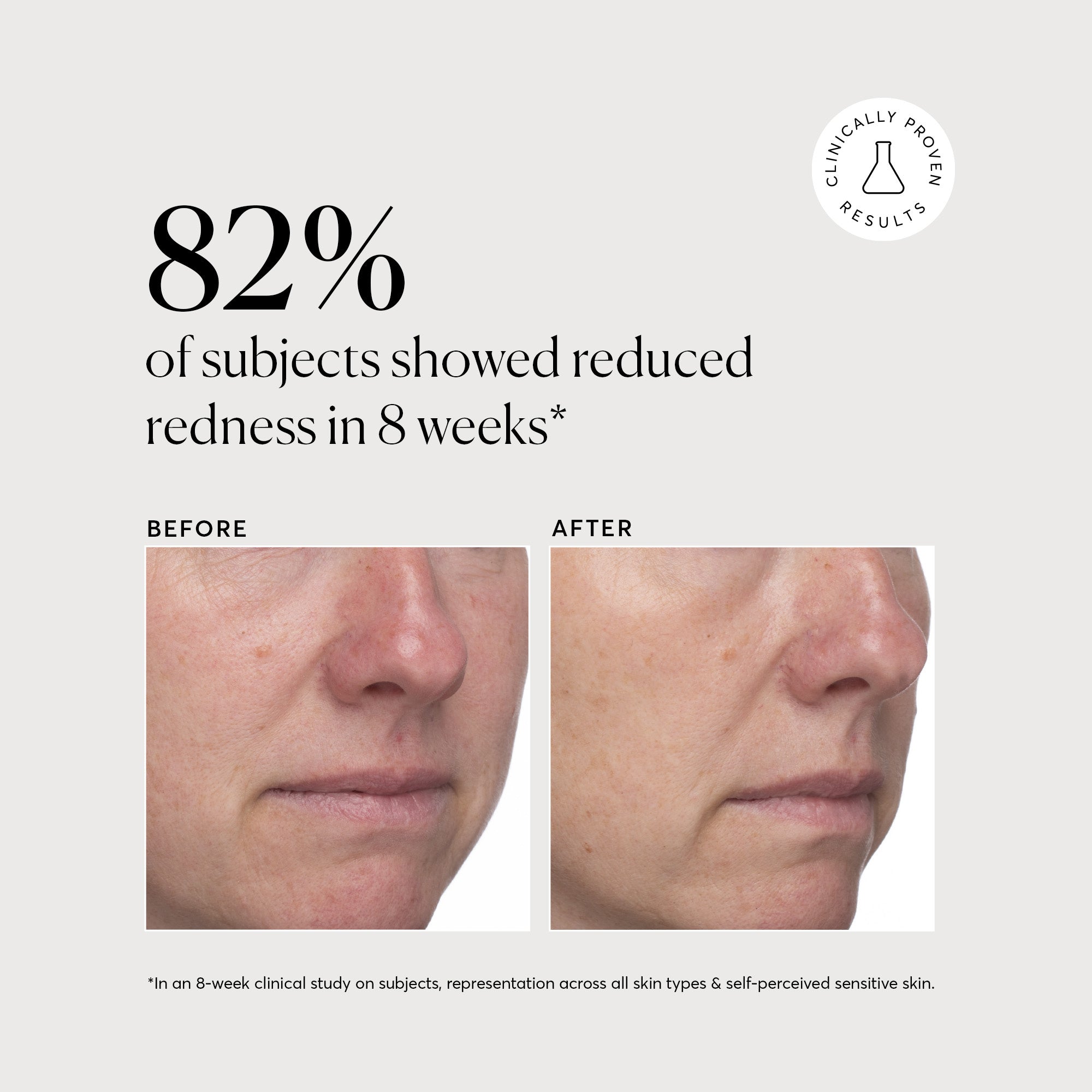 Azelaic Topical Acid 10%