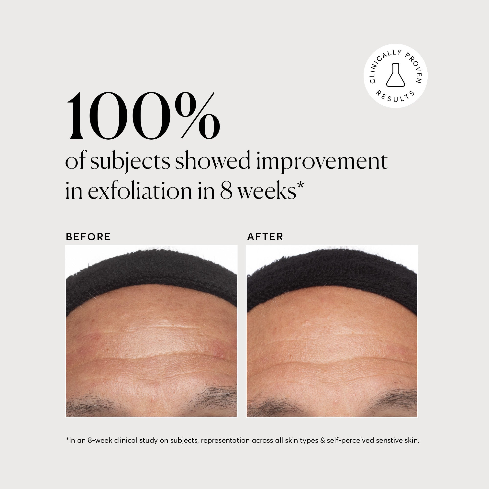 Azelaic Topical Acid 10%