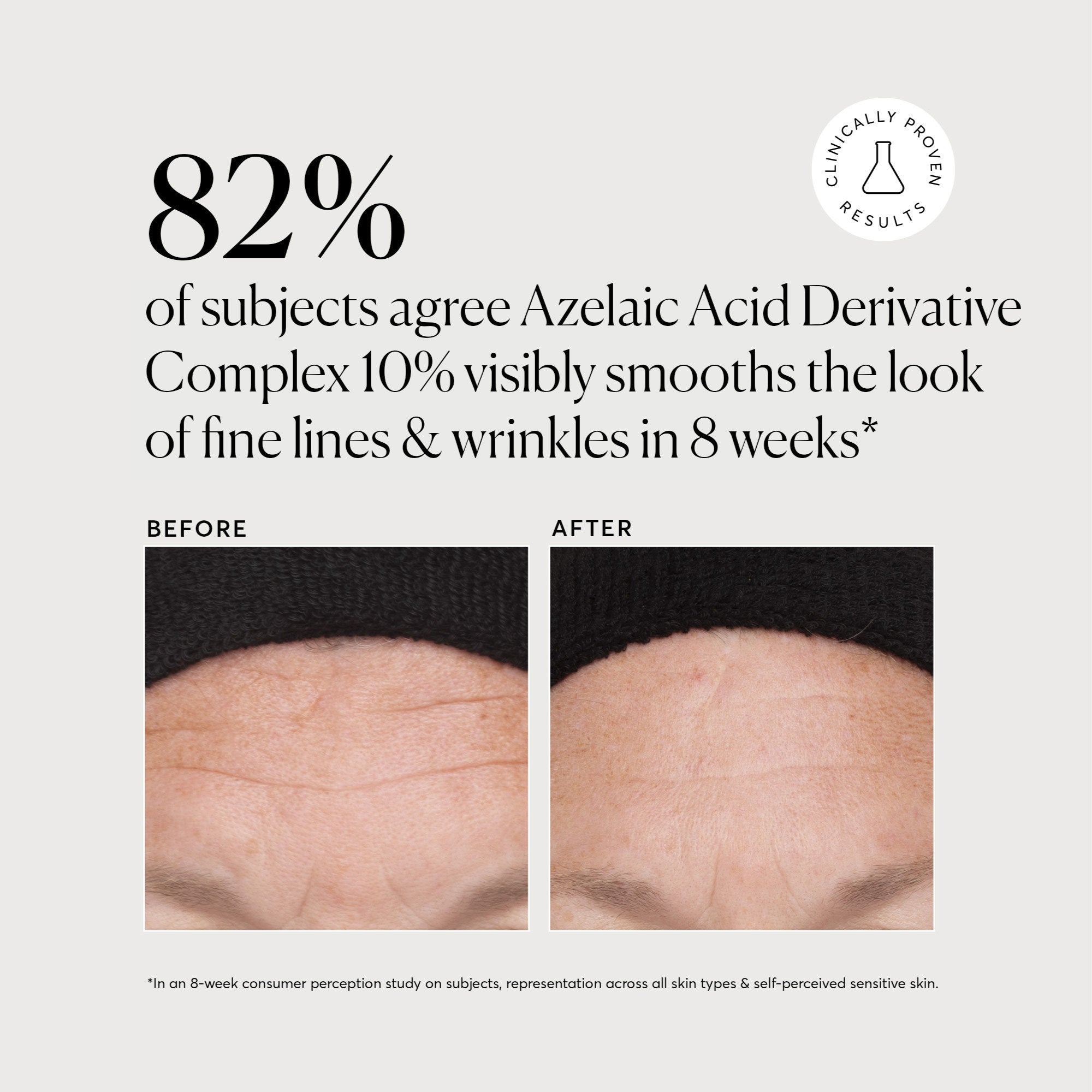 Azelaic Acid Derivative Complex 10% - Jumbo