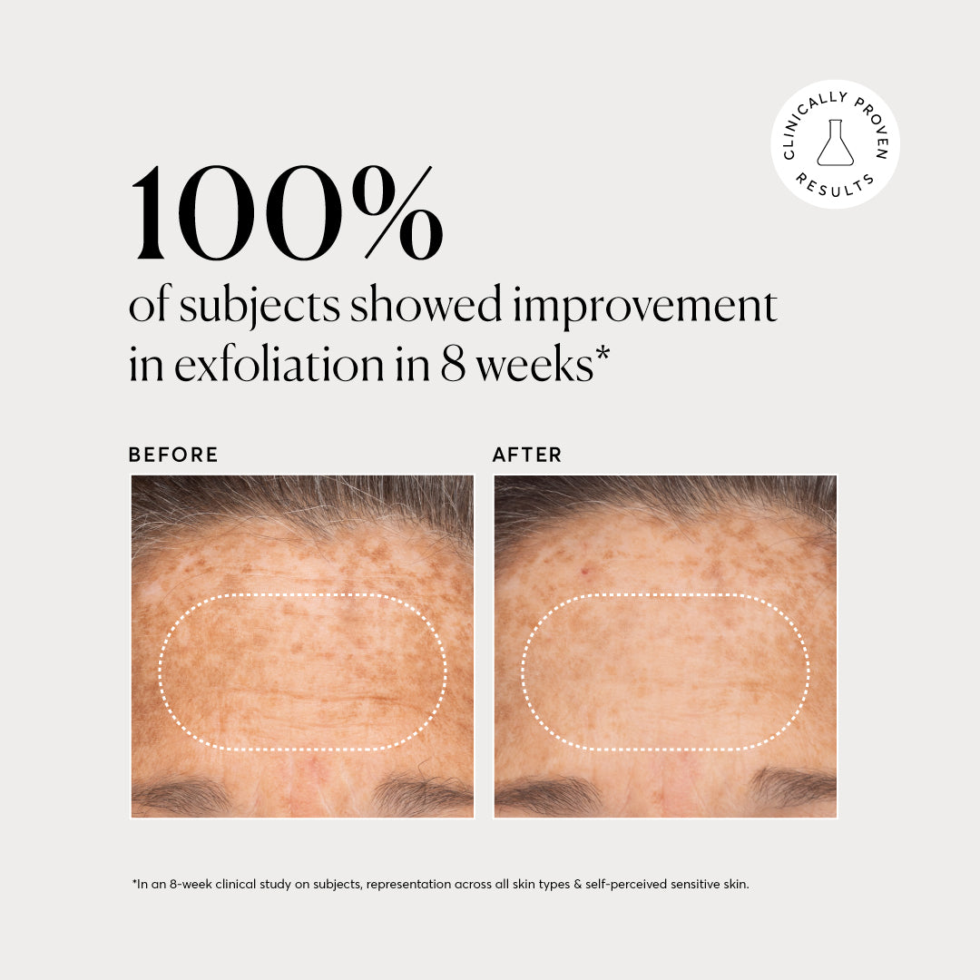 BHA Liquid Exfoliant 2%
