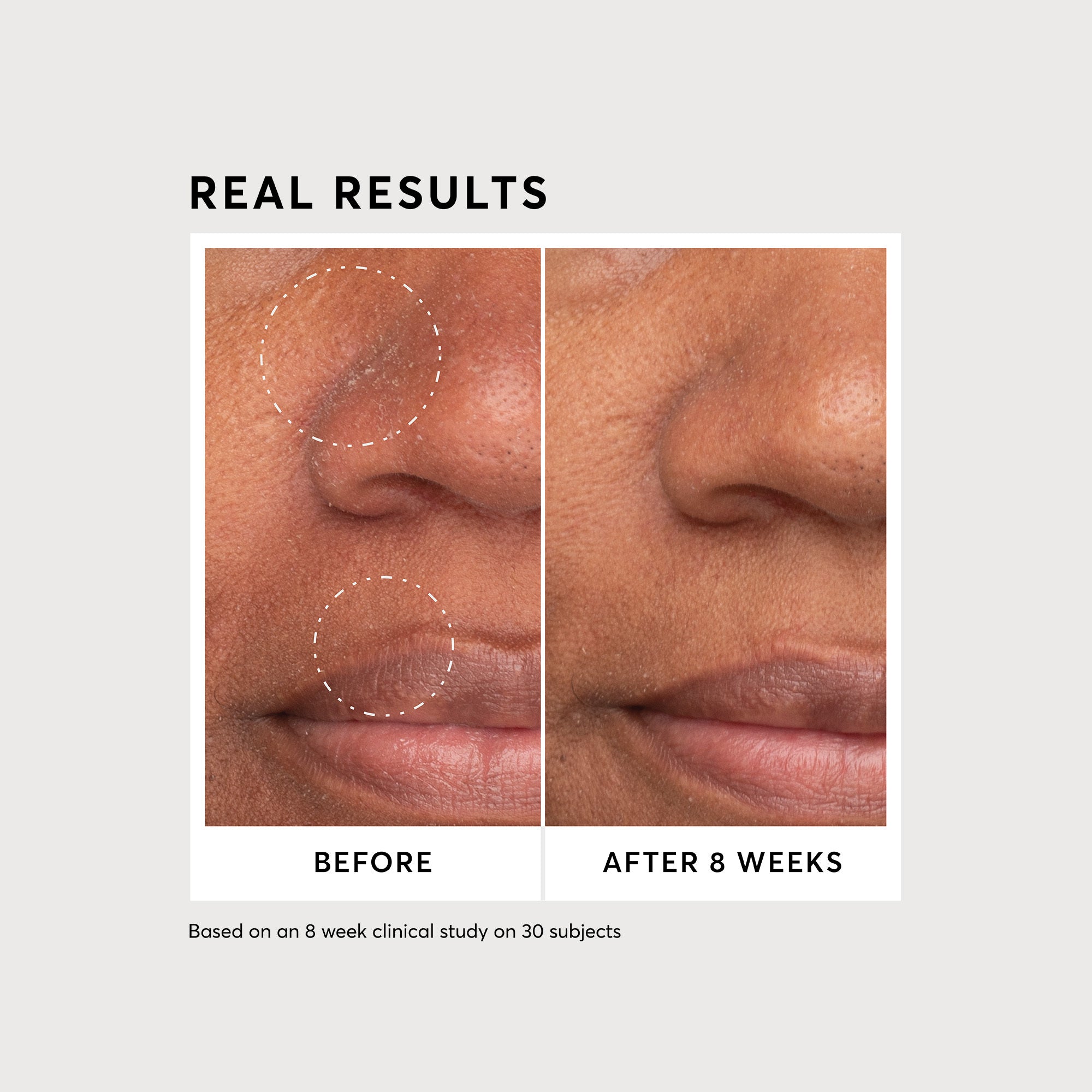 Niacinamide Serum 12% Plus Zinc 2% - Jumbo