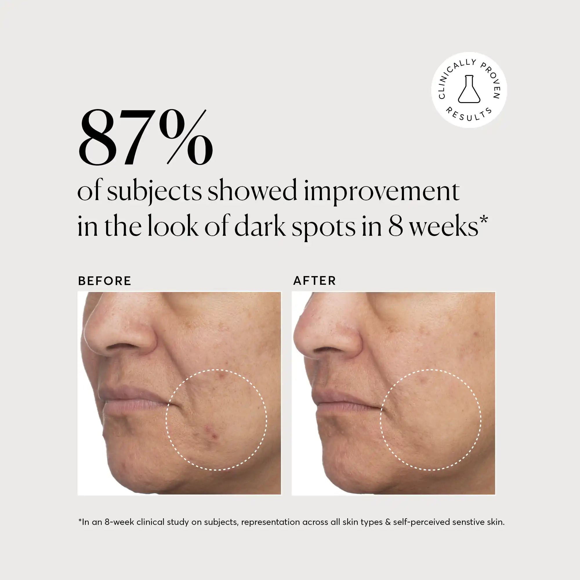 Tranexamic Topical Acid 5%