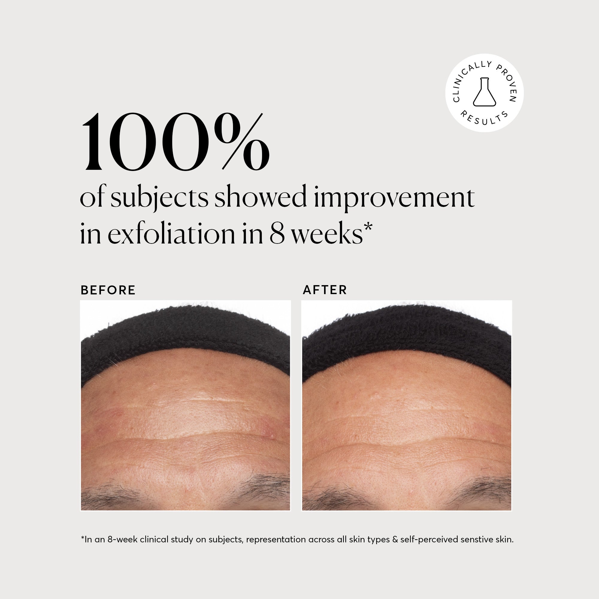 Azelaic Topical Acid 10%