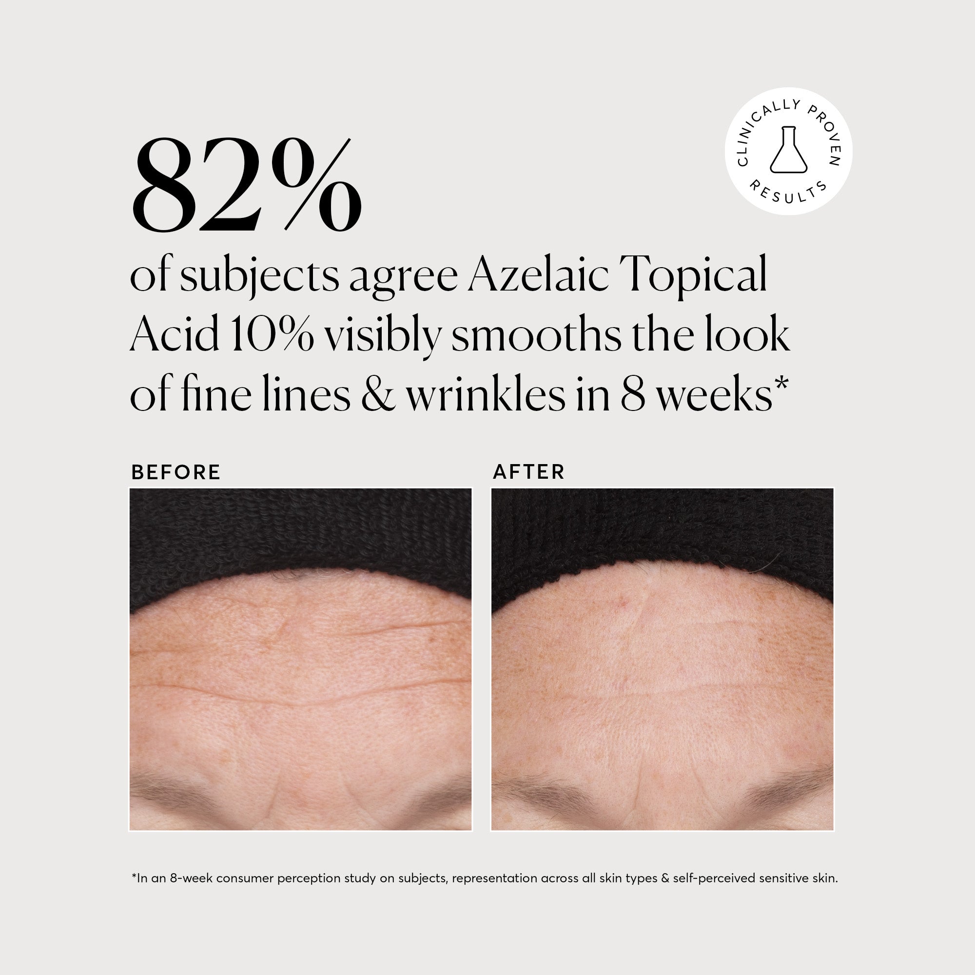 Azelaic Topical Acid 10%